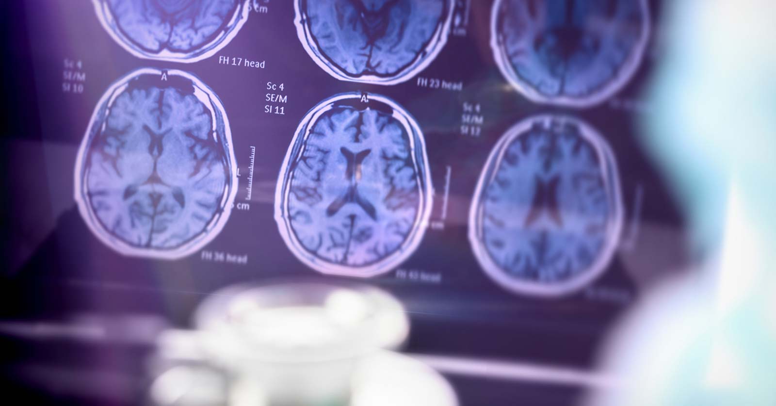 Alzheimers and Brain Awareness Month