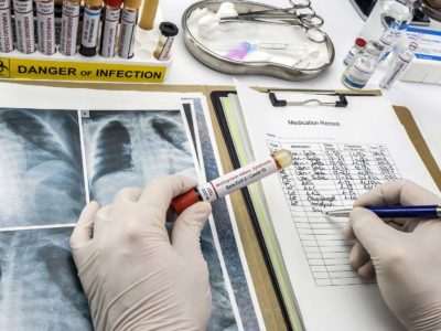 MIS-C Multisystem Inflammatory Syndrome in Children – Symptoms and Causes