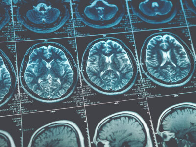CT Scan in Sugar Land Hospital