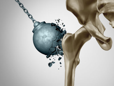 How To Keep Your Bones Healthy & Strong