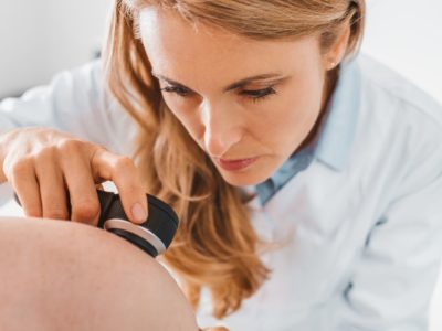 Skin Cancer Prevention