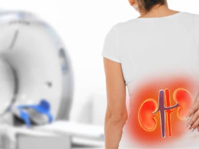 Signs of Kidney Failure