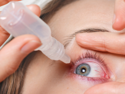 Pink Eye (Conjunctivitis)