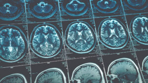 CT Scan in Sugar Land Hospital