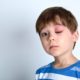 Eye Injuries – When to Go to the ER