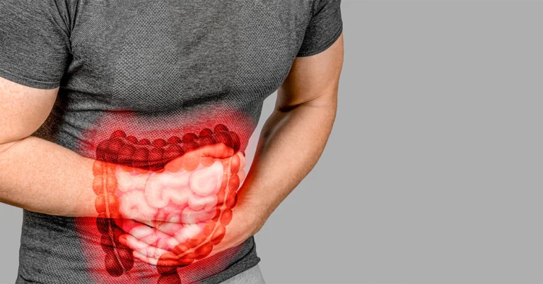 Person experiencing irritable bowel syndrome abdominal pain.