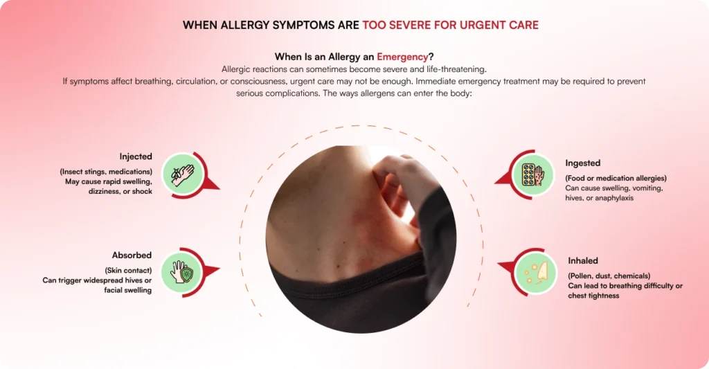 Allergy Treatment in Sugar Land
